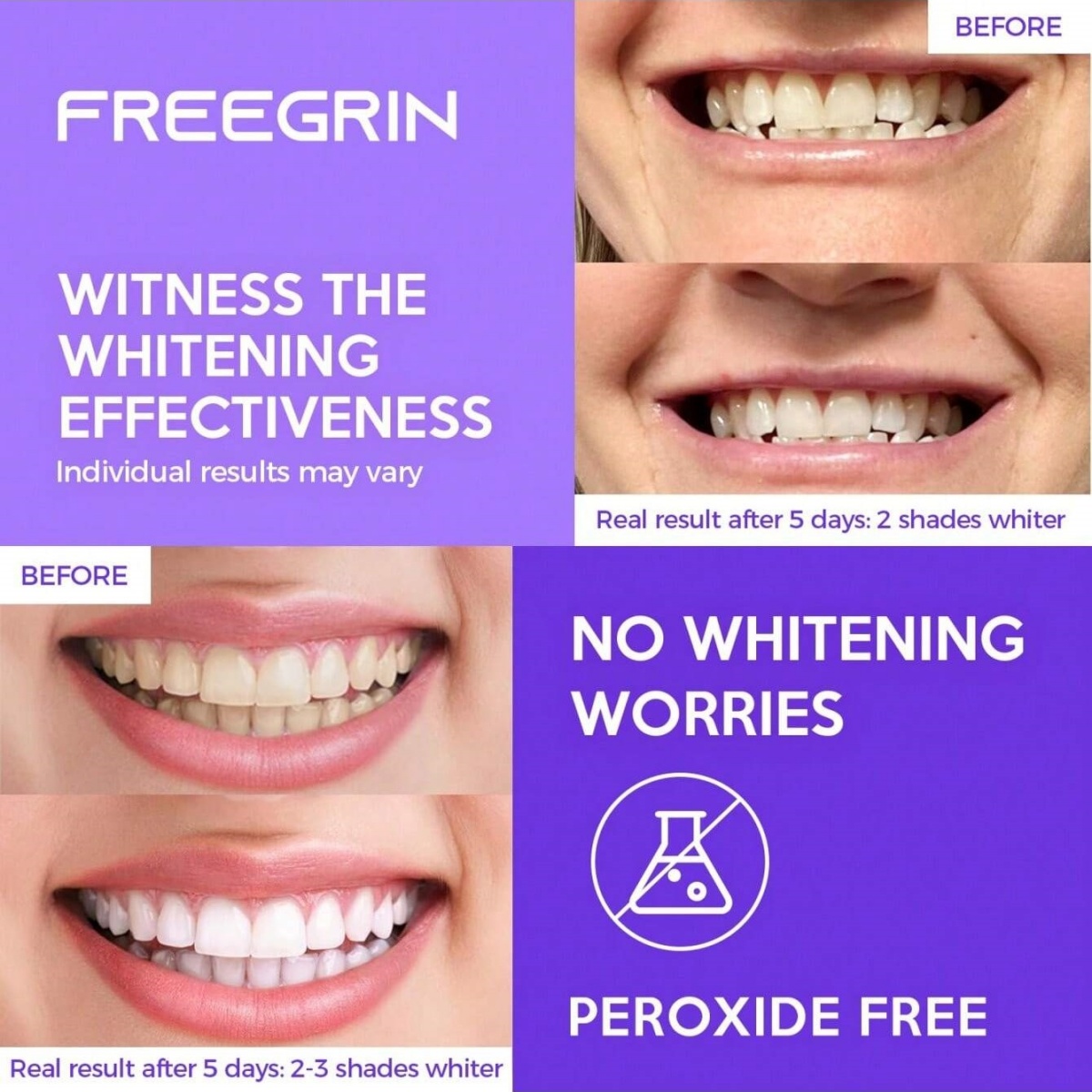 Deluxe Whitening Teeth Sticker - Home Fragrance Gel 评论和价格